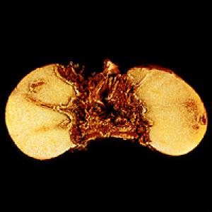 Bolesti gomolja gladiola